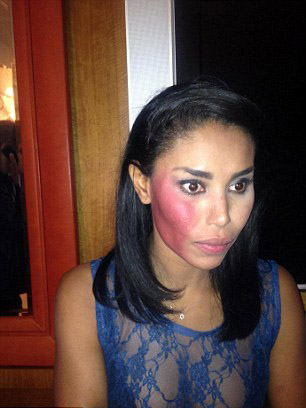 V. Stiviano