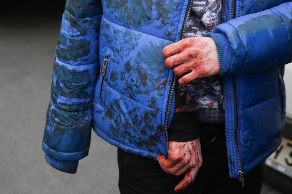 APRIL 3, 2017 - St. Petersburg, Russia - A man with bleeding hands at the entrance to Tekhnologichesky Institut station of the St Petersburg metro in the aftermath of an explosion which occurred in a train at 14:40 Moscow time; according to Russian National Antiterrorism Committee several people were killed in the explosion. (Credit Image: © Vaganov Anton/TASS via ZUMA Press)