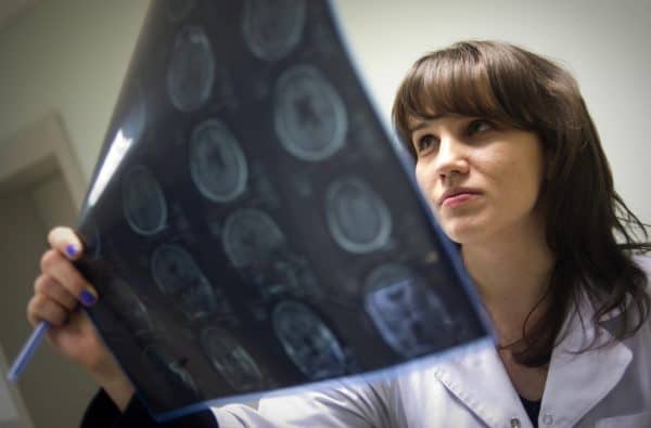 Doctor looks at brain scan